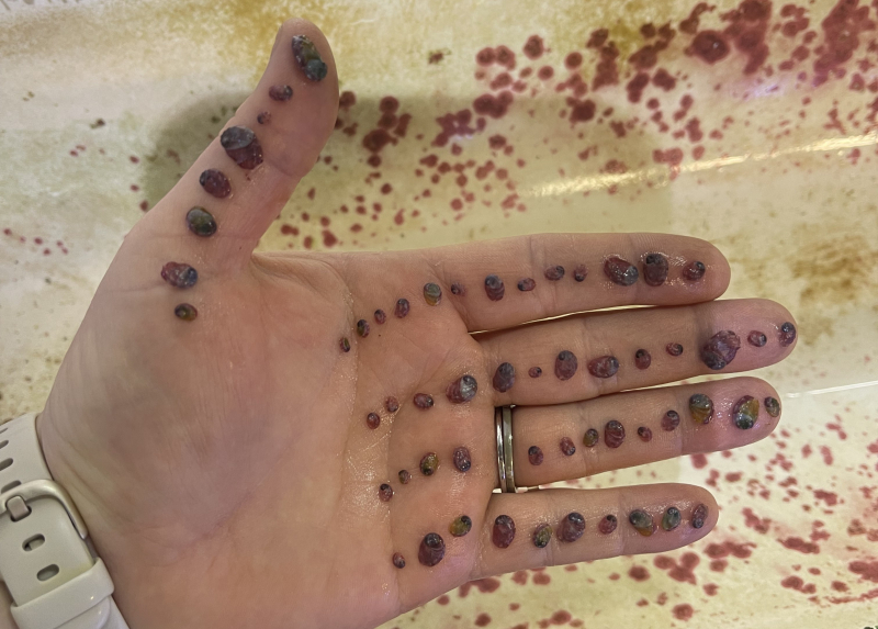 Tiny snails with shells like reddish beans lined up on a woman's hand